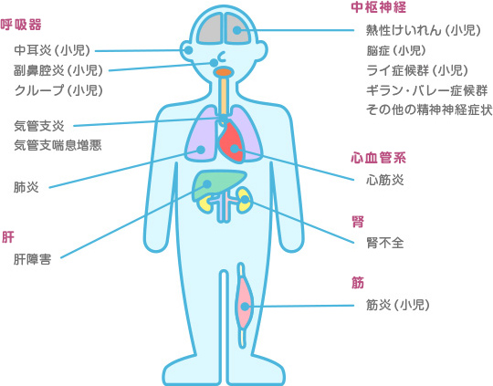 その他の合併症イメージ図。中枢神経や呼吸器、心血管系などでインフルエンザはさまざまな合併症を引き起こします。